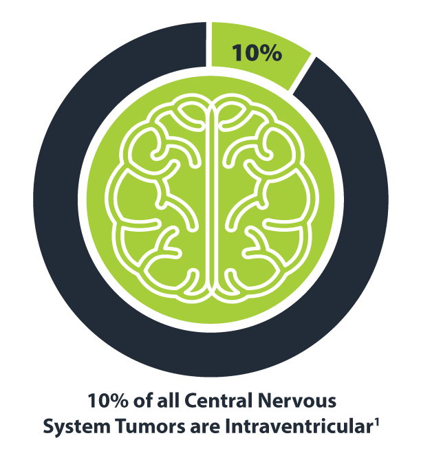 Approximately 10% of all central nervous system tumors are intraventricular