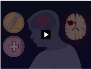 NEJM Quick Take - New ICH research findings short video